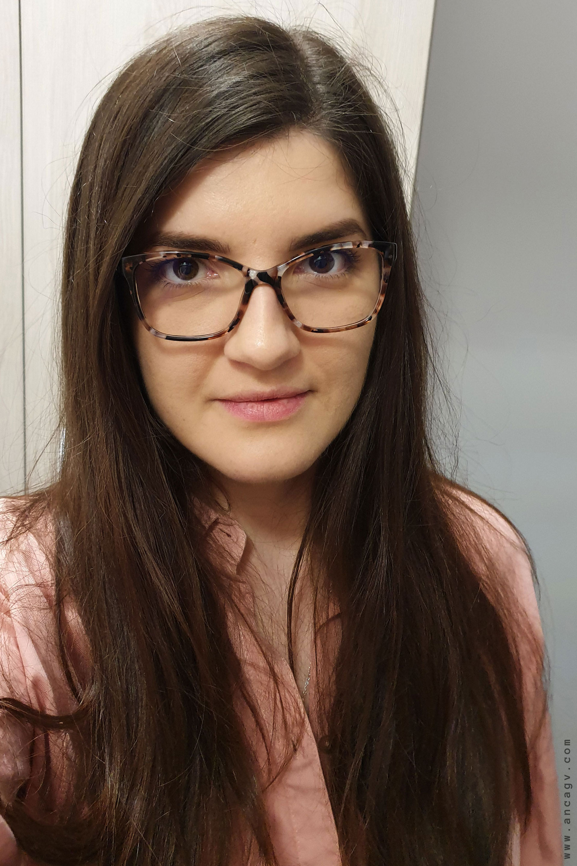 dupa-trei-luni-de-la-operatia-de-strabism-4